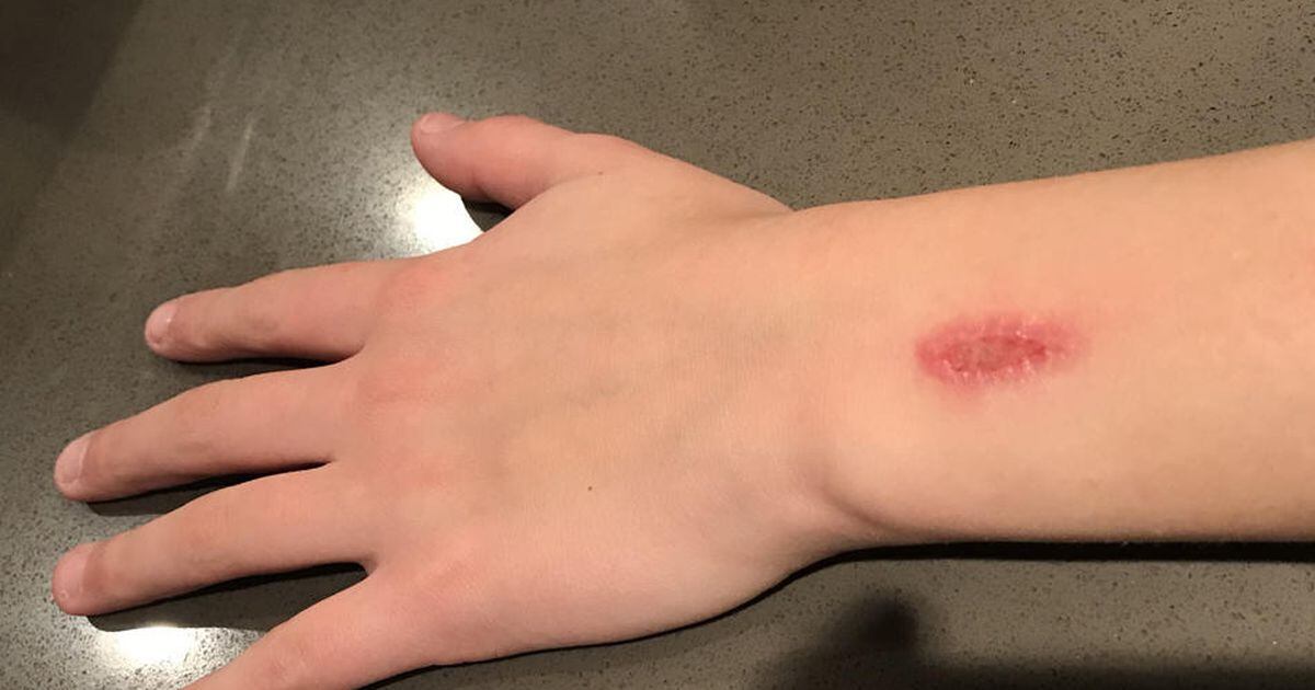 Middle school combating ‘Eraser Challenge’ Newton Daily News