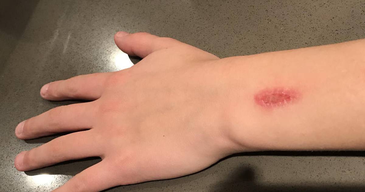 Middle school combating ‘Eraser Challenge’ Newton Daily News